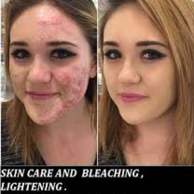 Skin Lightening Skin Whitening Products +27738432716
